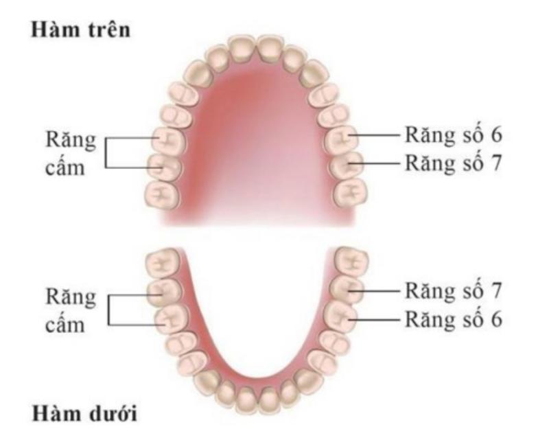 Nhổ răng cấm bao nhiêu tiền? quy trình nhổ răng cấm