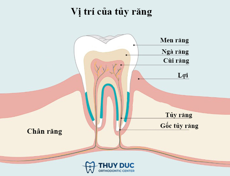 Thông thường răng lấy tủy có tồn tại được hết đời không?