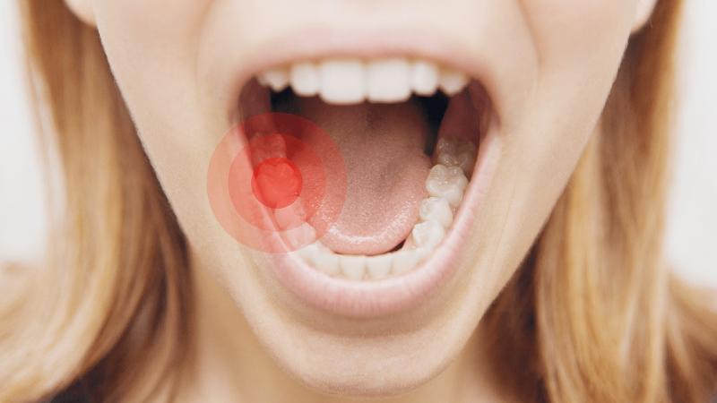 Nguyên nhân gây đau răng và cách trị đau răng tại nhà
