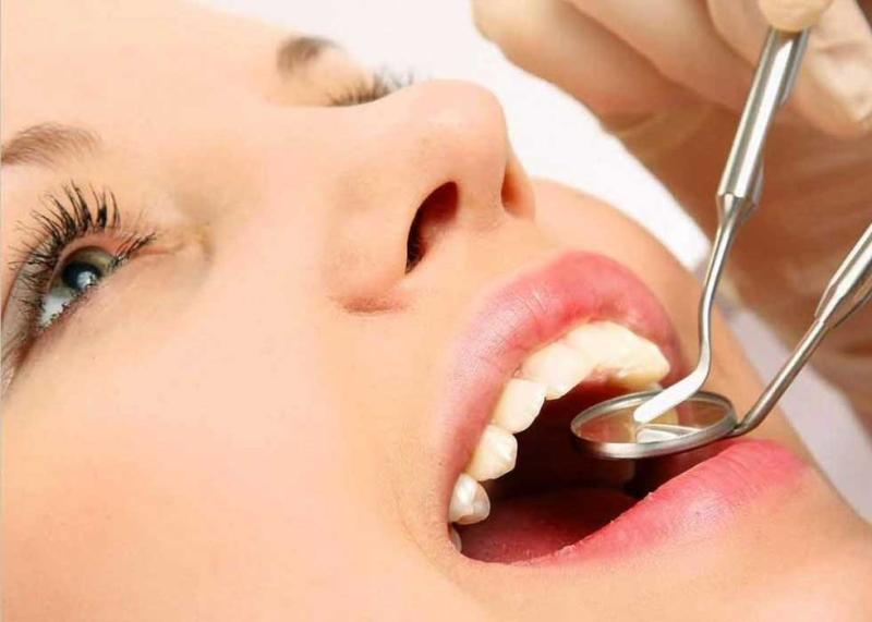 Cao răng là gì? Lấy cao răng có đau không?