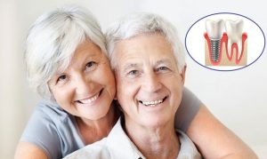 Cập nhật bảng chi phí làm răng giả? Lý do nên chọn nha khoa thẩm mỹ?