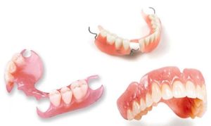 Tại sao phải làm răng giả? Lựa chọn nha khoa thẩm mỹ để làm răng giả