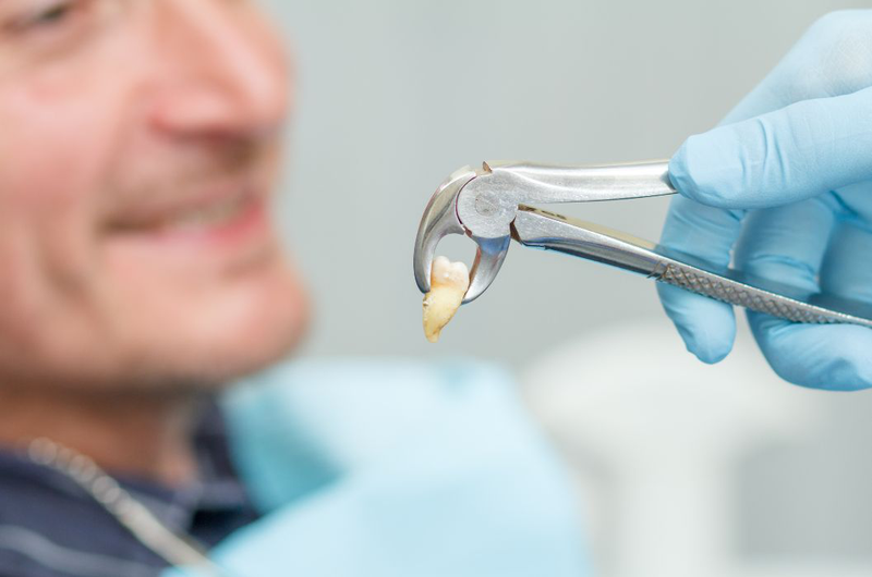 Những lưu ý khi nhổ răng kiêng ăn gì? Chăm sóc răng miệng sau khi nhổ răng